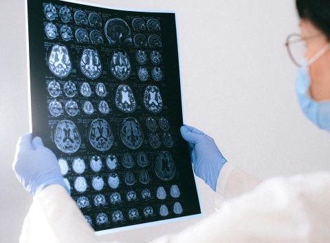 Doctor looking at Brain Scans. 