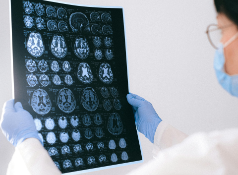 Doctor holding up image of MRI brain scans