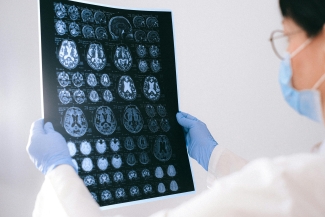 Doctor looking at Brain Scans. 