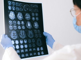 Doctor holding up image of MRI brain scans